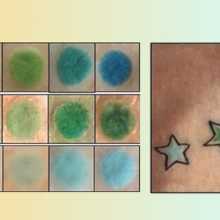 Επαναστατικά τατουάζ: Αλλάζουν χρώμα όταν αλλάζουν τα επίπεδα σακχάρου 