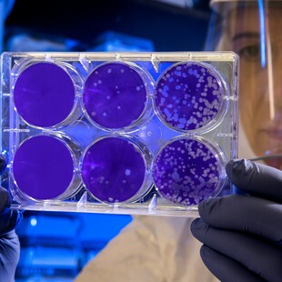 Βρέθηκαν «χαμένα» βακτήρια στα δόντια του Νεάντερταλ – Ελπίδες για ανάπτυξη νέων αντιβιοτικών