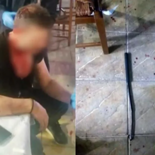 Αγρίνιο: Χτύπησαν με σίδερο εστιάτορα στο κεφάλι επειδή δεν τους άρεσε το φαγητό