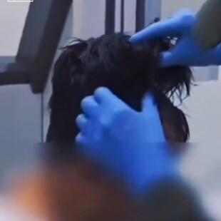 Κολομβία: Συνελήφθη με ποσότητα κοκαΐνης 10.000 δολαρίων στην περούκα του