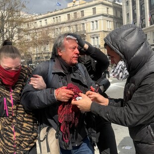 Τέμπη - Επεισόδια στην Αθήνα: Τραυματίστηκε ο φωτορεπόρτερ Ορέστης Παναγιώτου