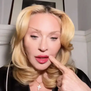 Αντιδράσεις για τα grills στα δόντια της Madonna - «Αυτό σίγουρα κοστίζει περισσότερο από το αυτοκίνητό μου»