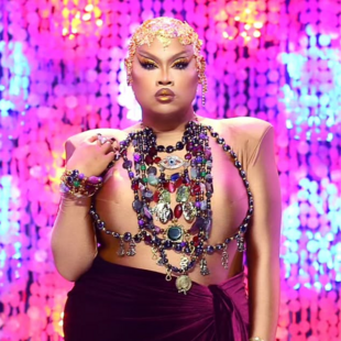 RuPaul’s Drag Race: Η Jiggly Caliente ακρωτηριάστηκε λόγω σοβαρής λοίμωξης 