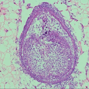Πιο κοντά από ποτέ τα «ζωντανά» δόντια που καλλιεργούνται στο εργαστήριο