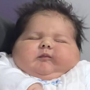 Αλί Ατίλα, το μωρό που έσπασε κάθε ρεκόρ στην Τουρκία: Γεννήθηκε με βάρος πάνω από έξι κιλά