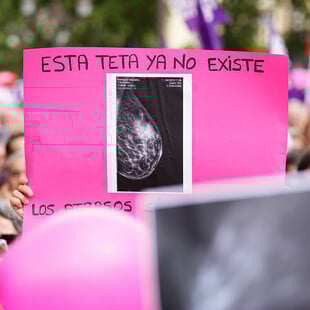 Μαστογραφία Ισπανία Καρκίνος του μαστού Σεβίλλη