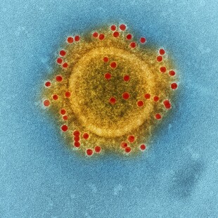 ΓΡΙΠΗ ΠΤΗΝΩΝ COVID