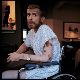 ΠΑΓΚΟΣΜΙΑ ΗΜΕΡΑ AIDS: ΑΥΤΟΙ ΠΟΥ ΔΕΝ ΠΡΟΛΑΒΑΝ