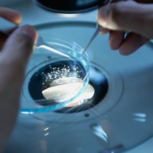 Καρκίνος: Σπάνιος τύπος παρουσιάζει απότομη αύξηση στις νεότερες ηλικίες