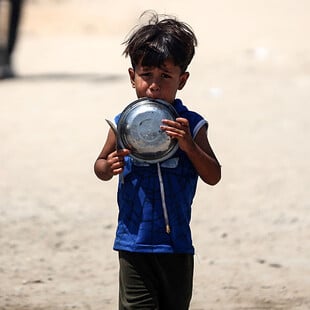 Γάζα: Πάνω από 9.000 παιδιά νοσηλεύτηκαν τον Οκτώβριο λόγω οξέος υποσιτισμού