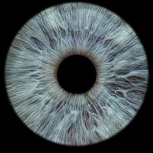 ΚΕΡΑΤΟΕΙΔΗΣ 3D ΕΚΤΥΠΩΣΗ ΟΡΑΣΗ