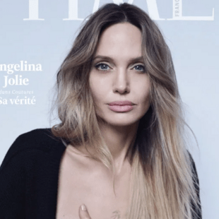 Η Ατζελίνα Τζολί αποκαλύπτει την ουλή από τη μαστεκτομή της στο TIME France
