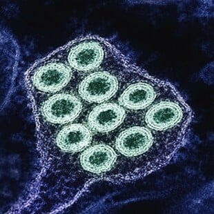 Η «υπεργρίπη» σαρώνει την Ευρώπη - Αυξάνεται η πίεση στα συστήματα υγείας προειδοποιεί ο ΠΟΥ