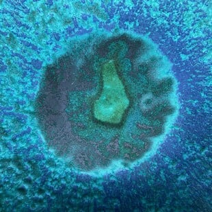 Επιστήμονες έφτιαξαν αντίγραφο του ενδομητρίου και εμφύτευσαν έμβρυα σε πρώιμο στάδιο