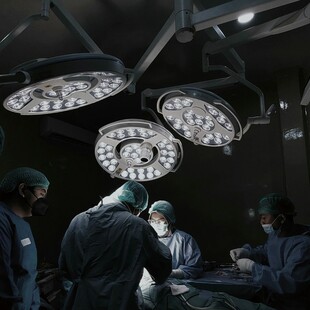 ΚΙΝΑ ΑΥΤΙ ΠΟΔΙ ΜΕΤΑΜΟΣΧΕΥΣΗ