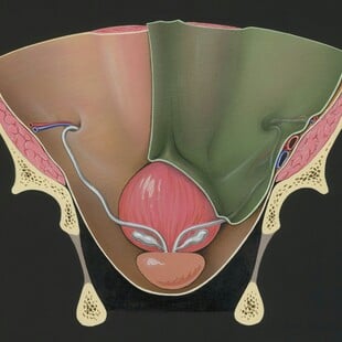 Φάρμακο για τον καρκίνο του προστάτη που παρατείνει τη ζωή θα διατεθεί στην Αγγλία