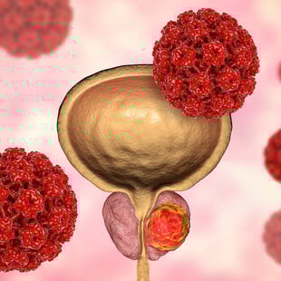 Φάρμακο για τον καρκίνο του προστάτη που παρατείνει τη ζωή θα διατεθεί στην Αγγλία