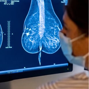 ΚΑΡΚΙΝΟΣ ΜΑΣΤΟΥ ΘΕΡΑΠΕΙΑ