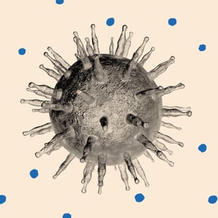 ΕΠΕΞ Καρκίνος παχέος εντέρου: Γιατί εμφανίζεται όλο και συχνότερα σε νέους