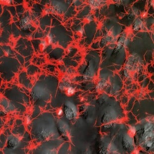 ΚΟΡΩΝΟΙΟΣ ΠΝΕΥΜΟΝΕΣ ΜΕΛΕΤΗ