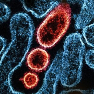 ΙΟΣ ΝΙΠΑ NIPAH 