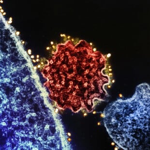 NIPAH ΙΟΣ ΠΑΓΚΟΣΜΙΟΣ ΟΡΓΑΝΙΣΜΟΣ ΥΓΕΙΑΣ