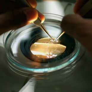 Μαζικός τάφος στην Ιορδανία αποκάλυψε την αρχαιότερη πανδημία που έχει καταγραφεί στον κόσμο