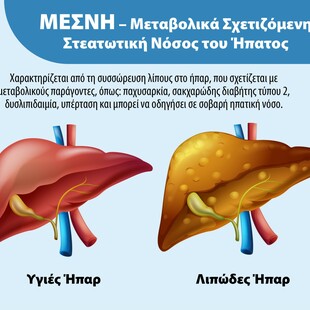 Hepatrat της UNI-PHARMA: Ευρωπαϊκή πατέντα & νέα δημοσίευση για τη συμβολή του σε ασθενείς με λιπώδες ήπαρ