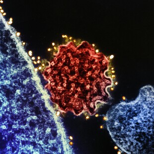 NIPAH ΙΟΣ ΜΠΑΝΓΚΛΑΝΤΕΣ