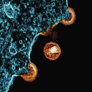 HIV ΘΕΡΑΠΕΙΑ ΧΑΠΙ