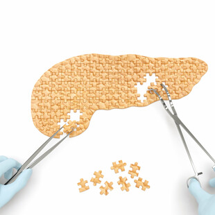 Βιβλιάριο παρακολούθησης, το νέο εργαλείο για τους κυστικούς όγκους του παγκρέατος