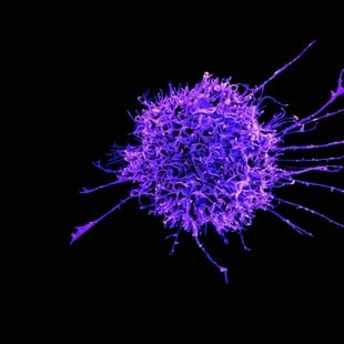 ΕΡΕΥΝΑ ΚΑΡΚΙΝΟΣ ΚΥΤΤΑΡΑ ΓΕΝΕΤΙΚΗ