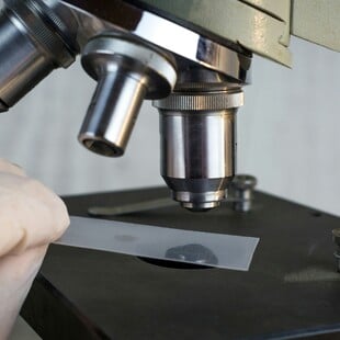 ΟΡΑΣΗ ΘΕΡΑΠΕΙΑ ΒΡΑΒΕΙΑ ΤΥΦΛΩΣΗ ΑΝΑΙΜΙΑ