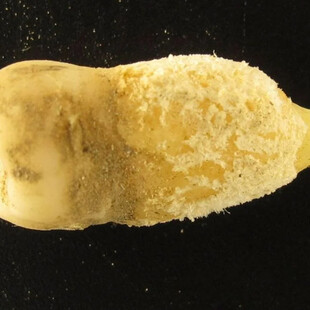 ΜΟΥΜΙΑ ΔΟΝΤΙ ΟΣΤΡΑΚΙΑ