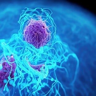 ΚΑΡΚΙΝΟΣ ΠΑΓΚΡΕΑΣ ΤΕΧΝΗΤΗ ΝΟΗΜΟΣΥΝΗ ΕΝΤΟΠΙΣΜΟΣ 