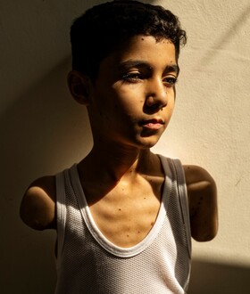 World Press Photo 2025: Πρώτο βραβείο στη φωτογραφία 9χρονου Παλαιστίνιου που ακρωτηριάστηκε