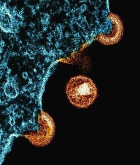 HIV: Ο FDA ενέκρινε τη μοναδική ένεση στον κόσμο για πρόληψη του ιού