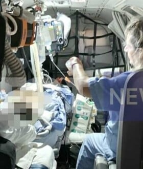 ΘΕΡΜΟΠΛΗΞΙΑ ΜΟΣΧΕΥΜΑ