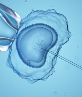 Άνδρες και υπογονιμότητα: Γιατροί προειδοποιούν ότι χιλιάδες ζευγάρια μπαίνουν άδικα σε IVF