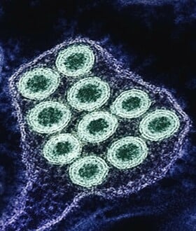 Η «υπεργρίπη» σαρώνει την Ευρώπη - Αυξάνεται η πίεση στα συστήματα υγείας προειδοποιεί ο ΠΟΥ