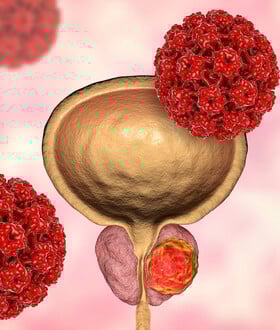Φάρμακο για τον καρκίνο του προστάτη που παρατείνει τη ζωή θα διατεθεί στην Αγγλία