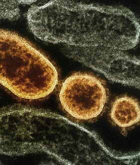 Γρίπη: Δεκάδες κρούσματα στα νοσοκομεία - Κυριαρχεί η υποπαραλλαγή Κ