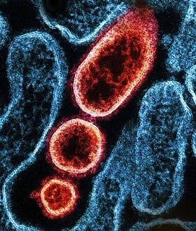 ΙΟΣ ΝΙΠΑ NIPAH 