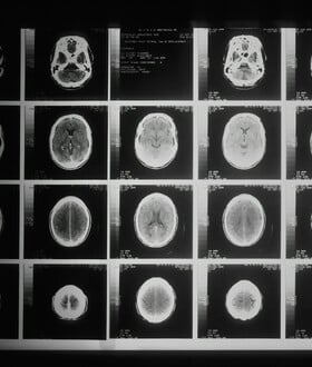 ΜΗΝΙΓΓΙΤΙΔΑ