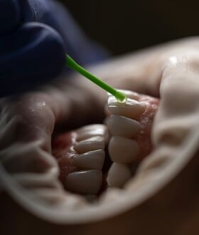 ΛΟΙΜΩΞΗ ΔΟΝΤΙ ΚΑΡΔΙΑ