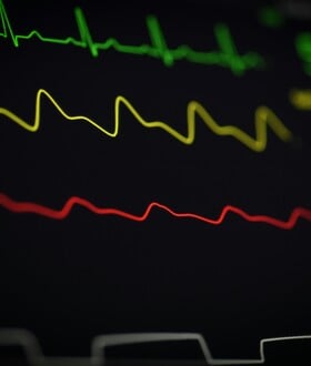 ΚΑΡΔΙΑ ΑΡΡΥΘΜΙΑ ΤΑΧΥΚΑΡΔΙΑ ΕΡΕΥΝΑ