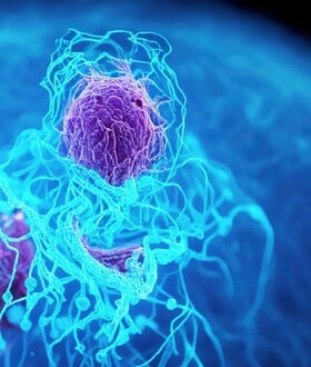 ΚΑΡΚΙΝΟΣ ΠΑΓΚΡΕΑΣ ΤΕΧΝΗΤΗ ΝΟΗΜΟΣΥΝΗ ΕΝΤΟΠΙΣΜΟΣ 