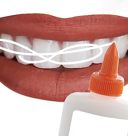 Οι συνέπειες ενός trend που θέλει τα δόντια λευκά μέχρι υπερβολής