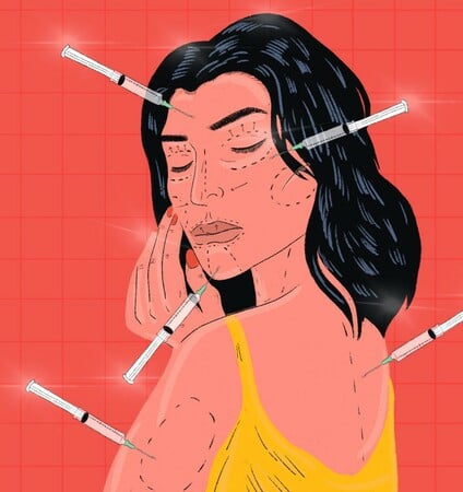 Πότε έγινε το botox η νέα «ρουτίνα» των εικοσάρηδων;
