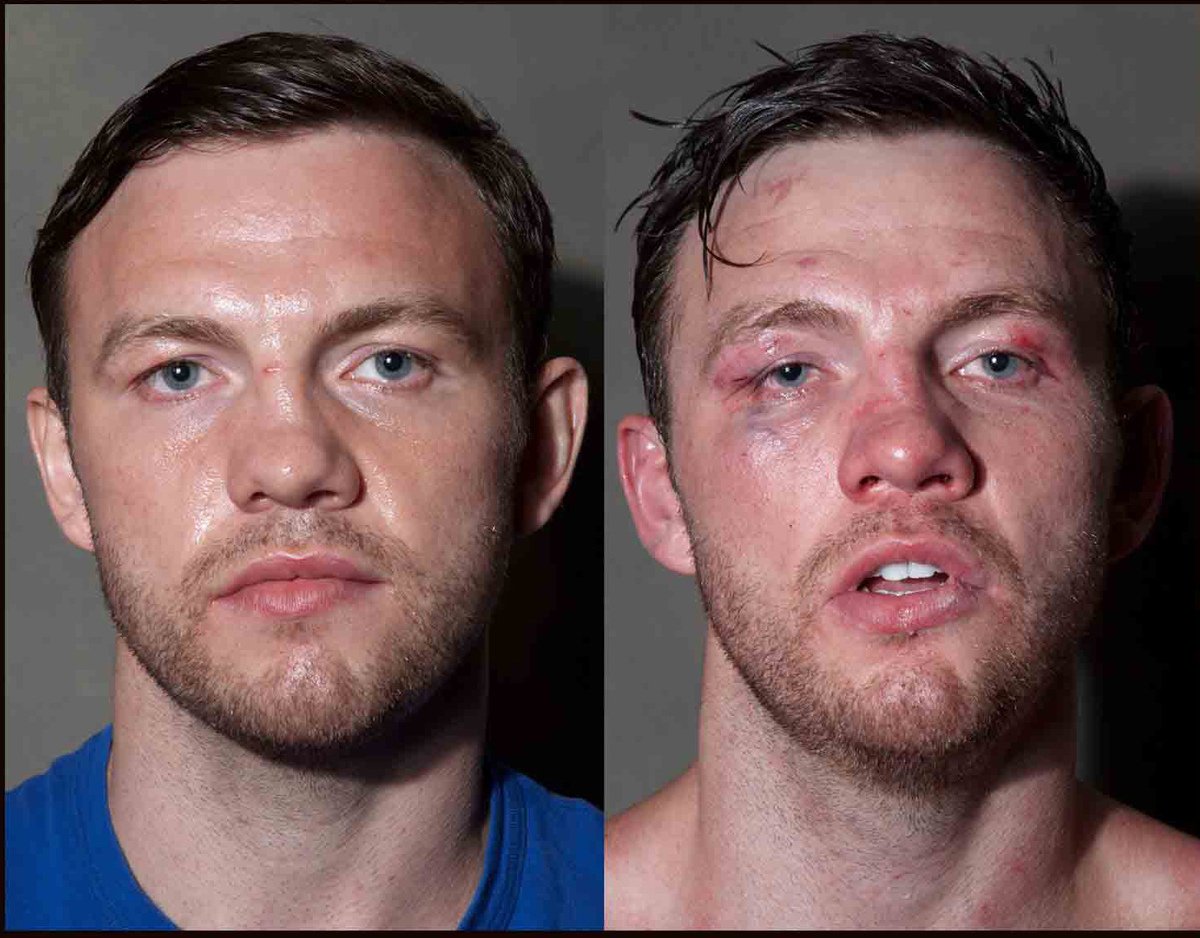 Εικόνες πυγμάχων πριν και μετά τον αγώνα